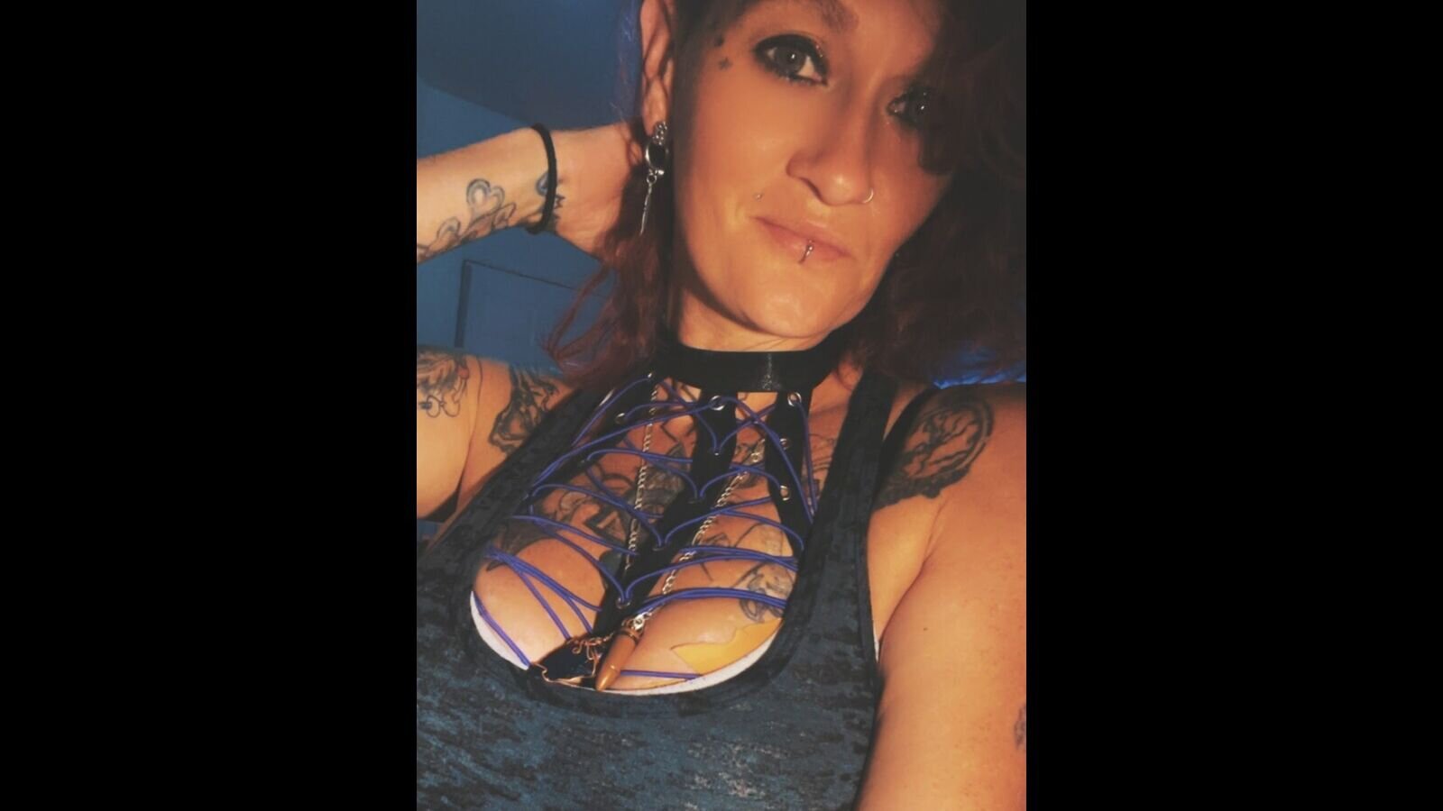 ReneVyx
